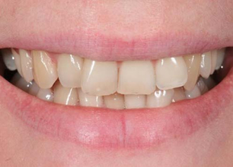smile gallery