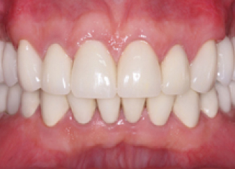 smile gallery